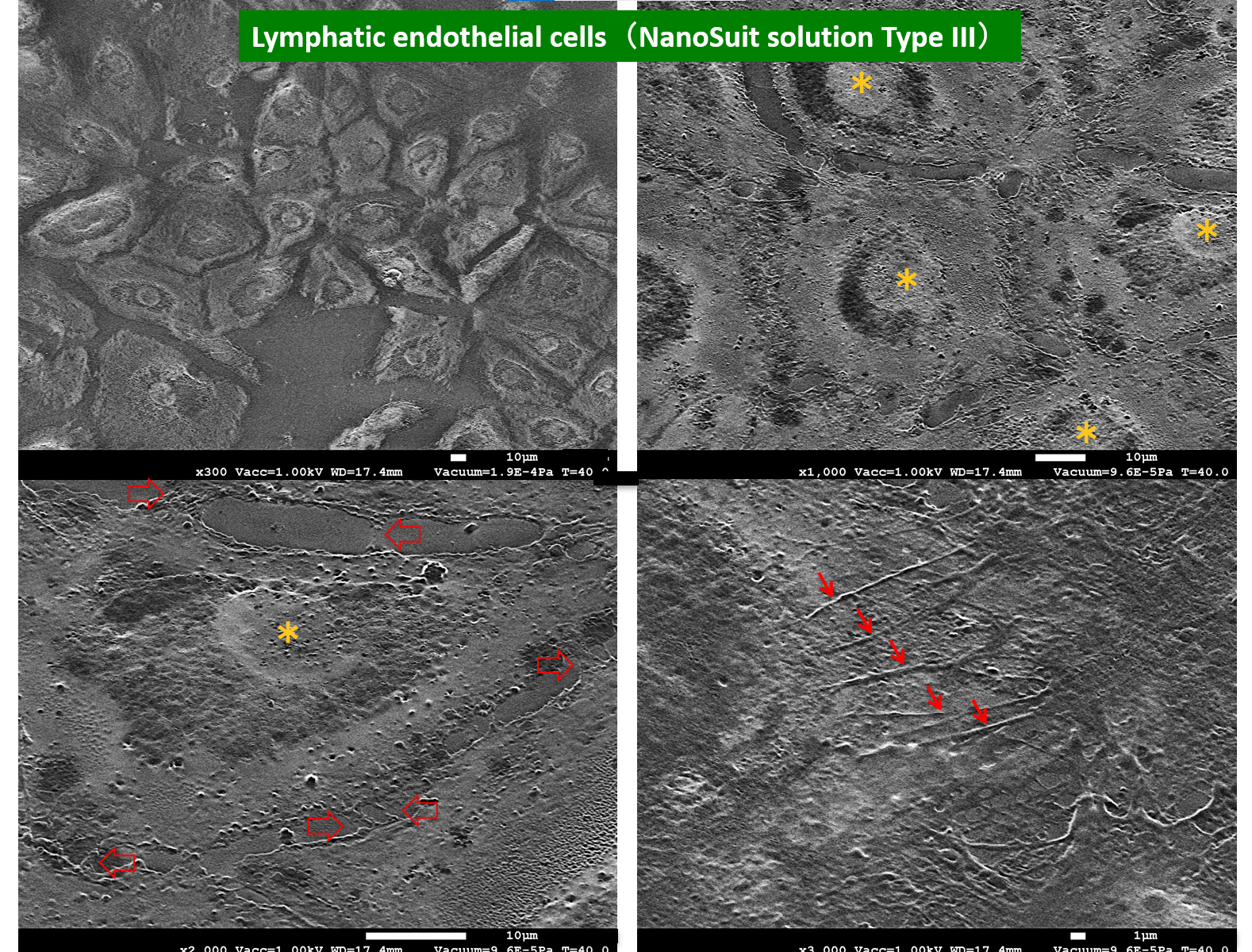 Lymphatic endothelial cells