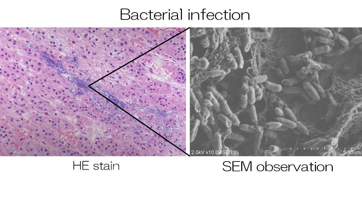 Bacterial infection