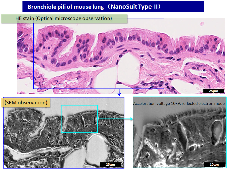 Bronchiole pili of mouse lung