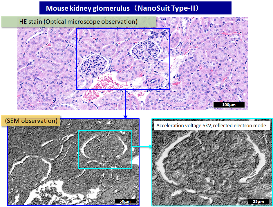 Mouse kidney glomerulus
